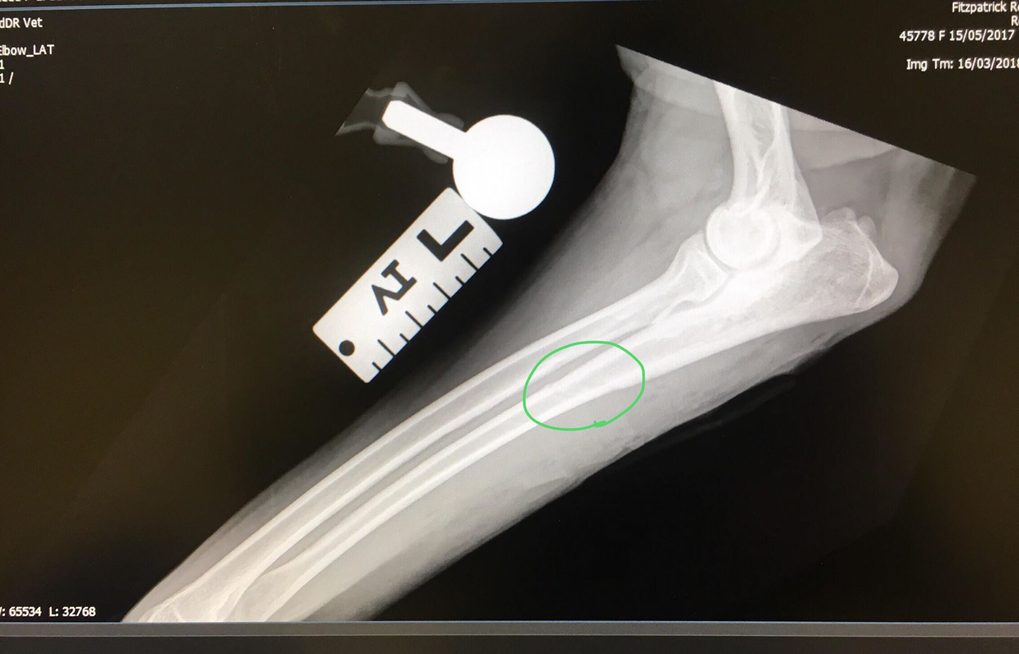 Rosie elbow x ray 1