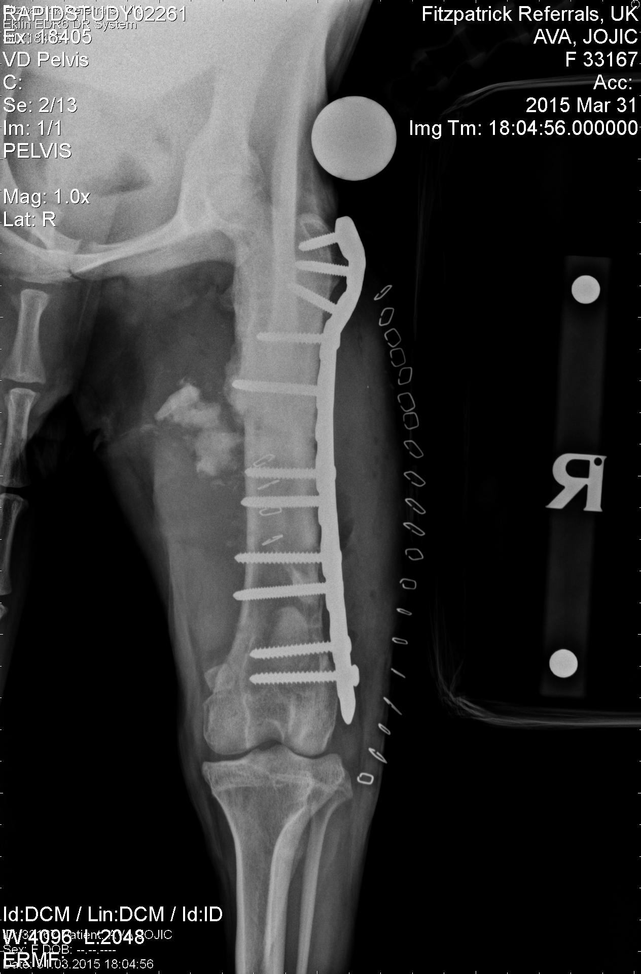 ava pelvis repair