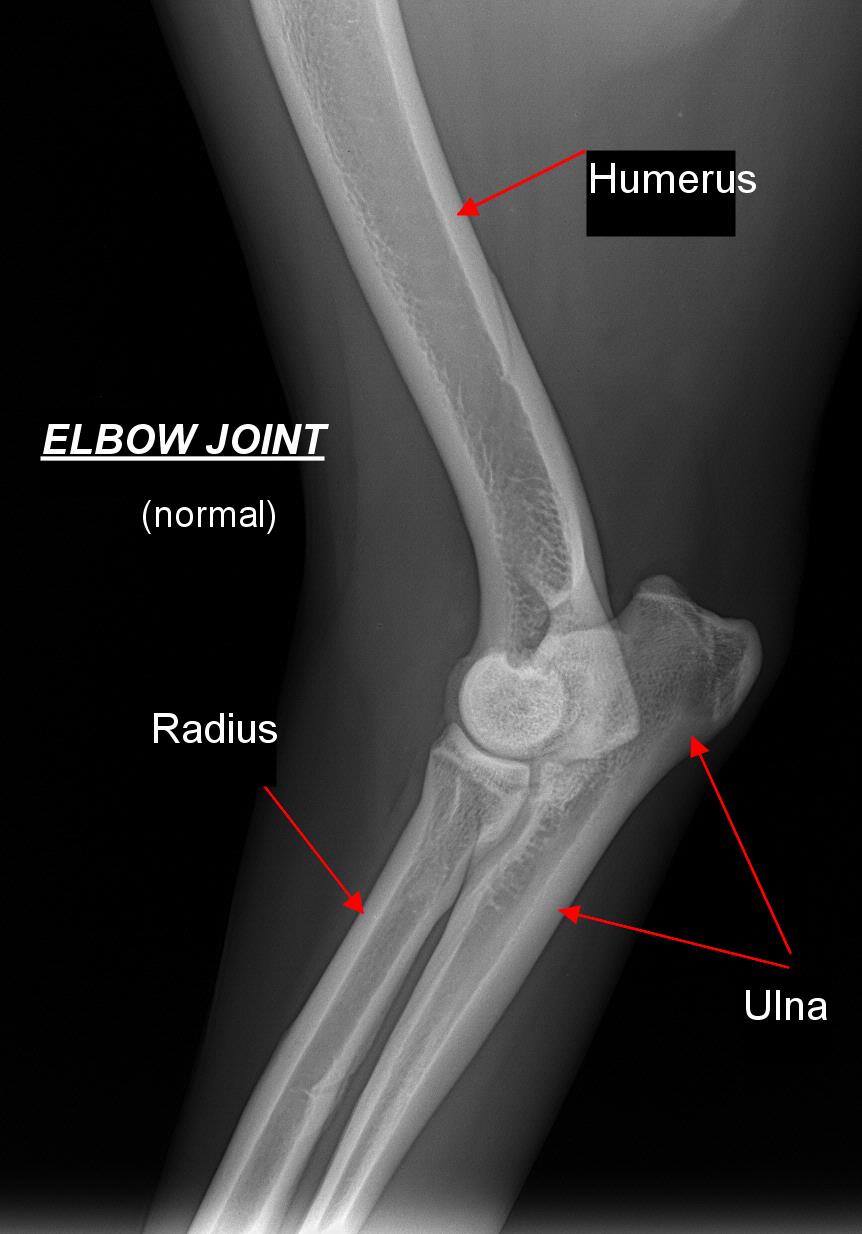 normal elbow